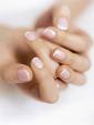 Белые пятна на ногтях – причины появления